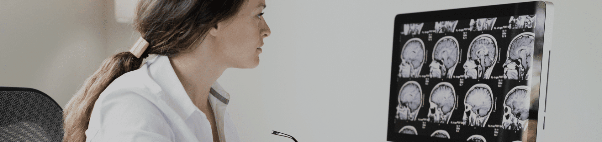 San Diego Brain Injury Lawyer